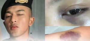 Buntut Kasus Dugaan Penganiayaan, Polda Jabar Tahan Bripda AA