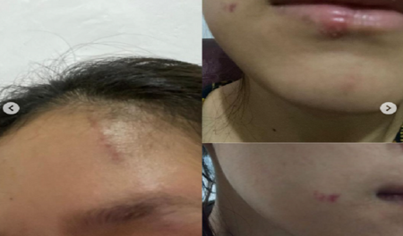 Tragis! Ibu Muda di Bandung Alami KDRT, Polisi Lakukan Penyelidikan