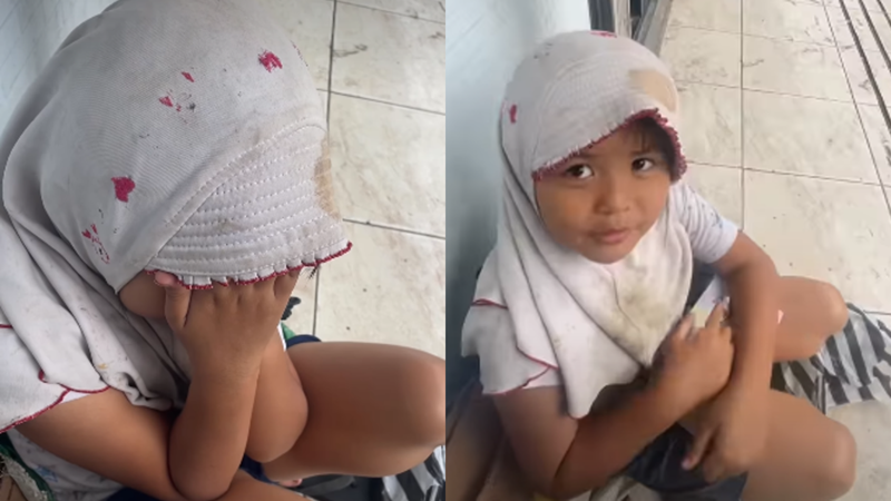 Cuma Pakai Karung ke Sekolah! Bocah SD Ini Terpaksa ‘Ngebadut’ Demi Obat Mamah