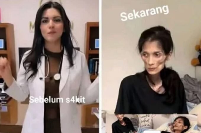 Dulu Dipuja, Dokter Cantik Ini Kini Kurus Kering Digerogoti Penyakit Misterius? Ini Fakta Mengejutkannya!